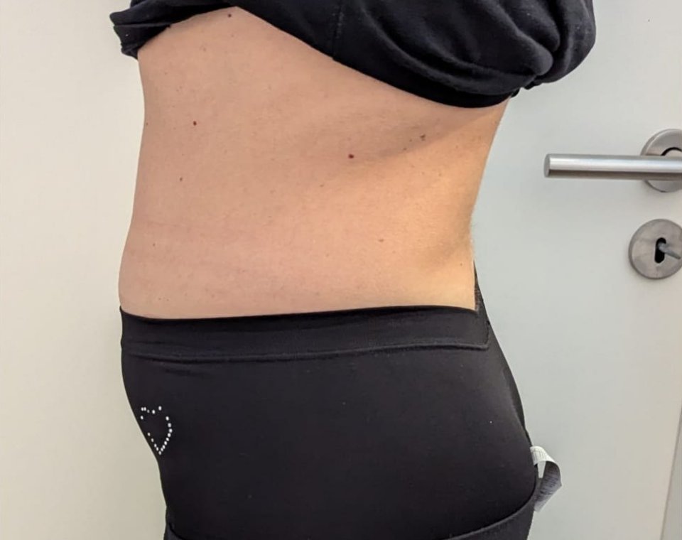 Vorher-Aufnahme Cryo-Metabolic, Zone Taille